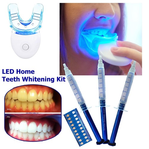 Teeth whitening kit - whitening, gel