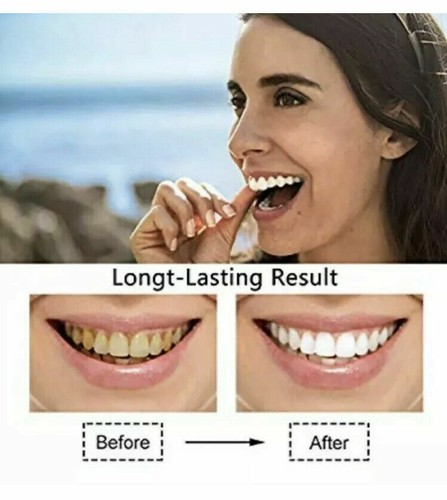 Sewobye teeth whitening kit - teeth,